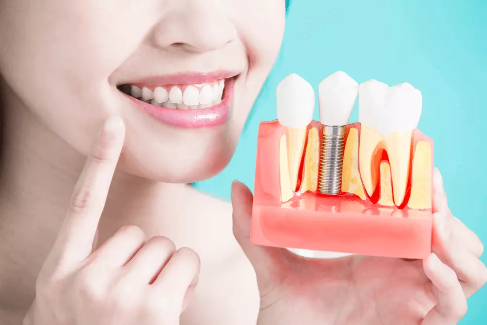 How to start With permanent tooth prosthesis