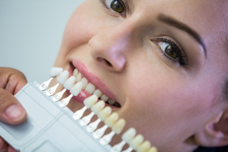 Best Tooth Coloured Filling Centre in Kanpur