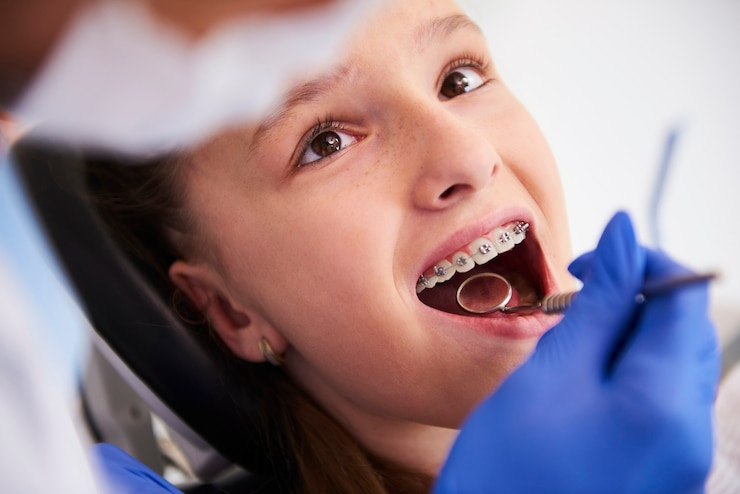 Best Dental Braces in Indira Nagar